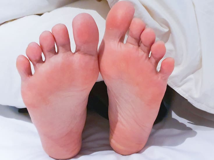 Qué son los juanetes y cómo tratarlos a tiempo