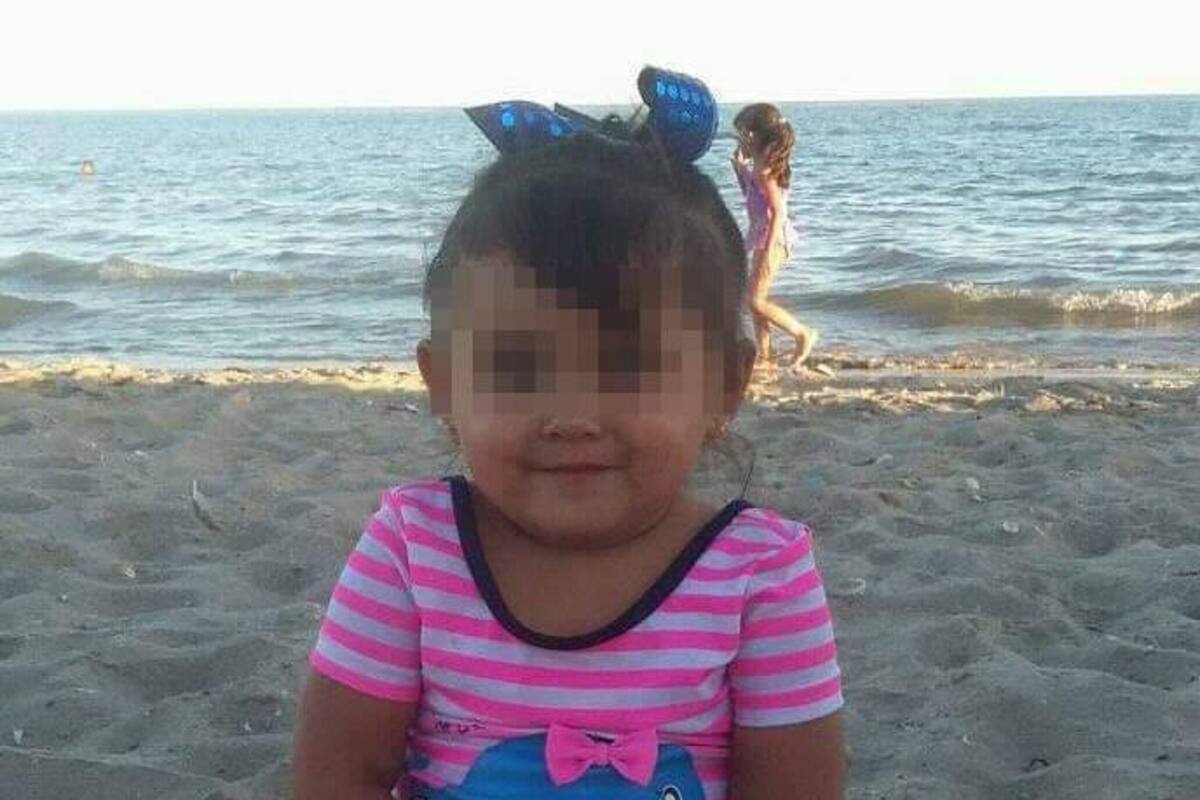 Le amputan pierna a Keyli Cristal, niña que sobrevivió a incendio en Empalme