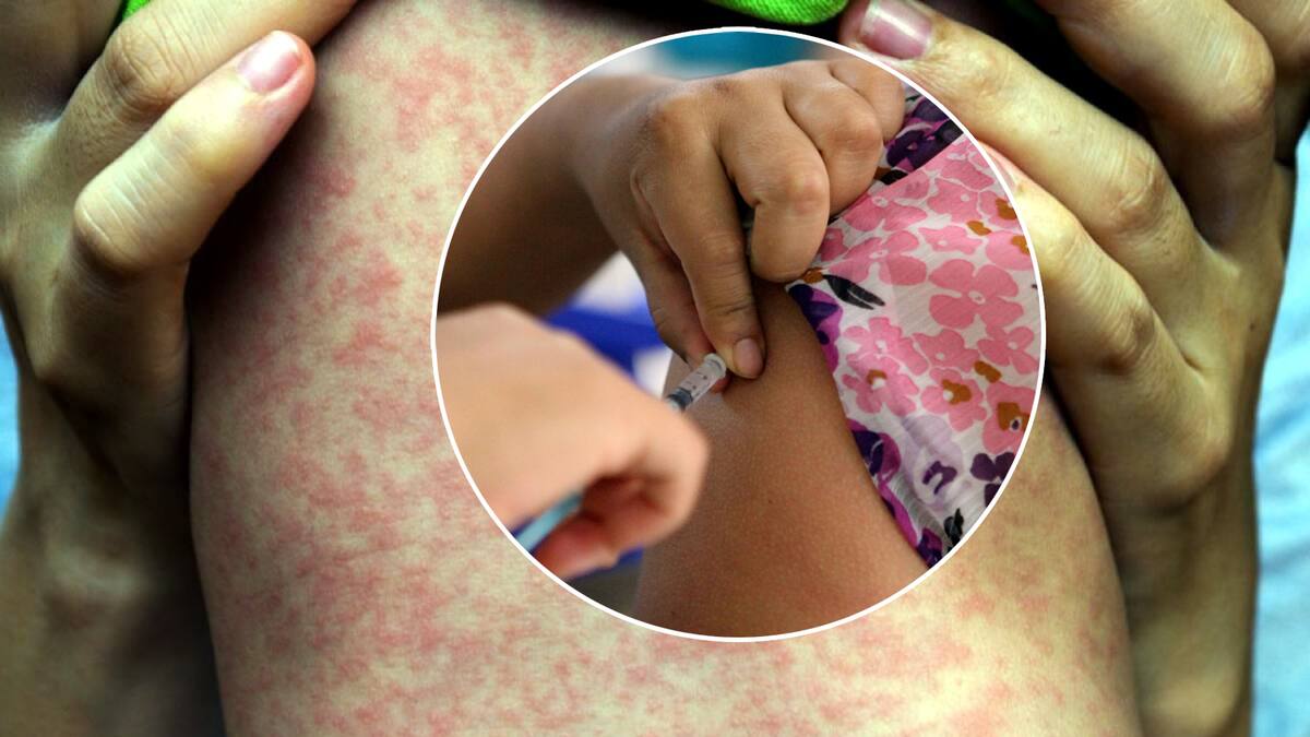 Inicia campaña nacional de vacunación a partir del 1ro de abril