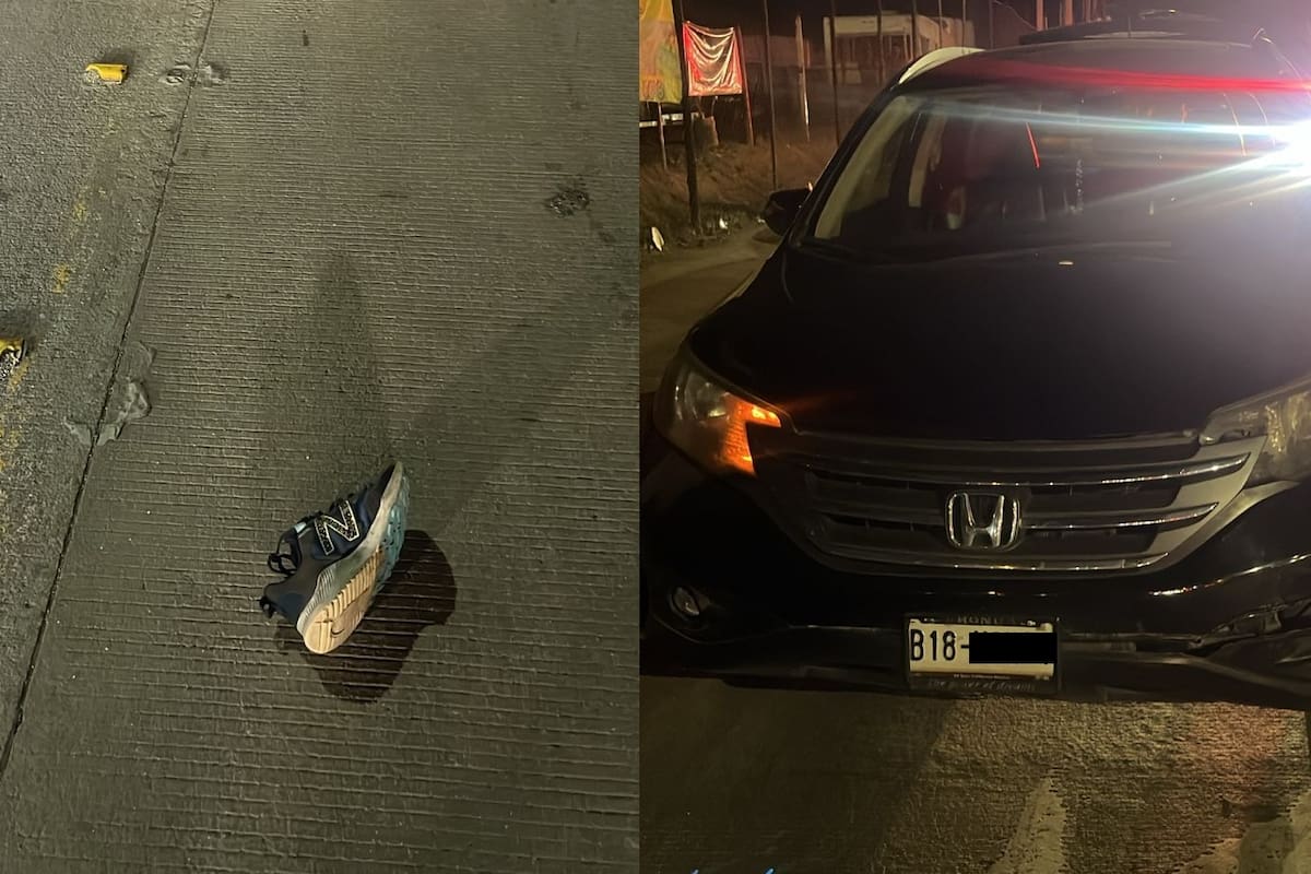 Mujer resulta gravemente lesionada tras ser atropellada en la calzada Héctor Terán Terán