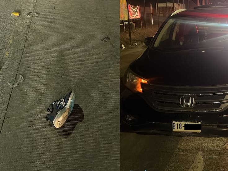 Mujer resulta gravemente lesionada tras ser atropellada en la calzada Héctor Terán Terán