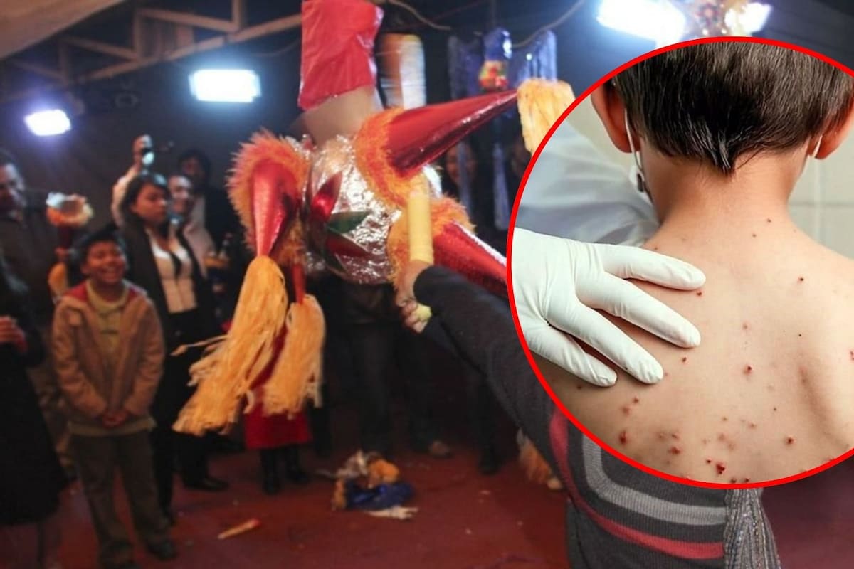 Chiapas pide cancelar eventos masivos tras detectar decenas de casos de sarampión; alerta se extendería hasta marzo de 2026