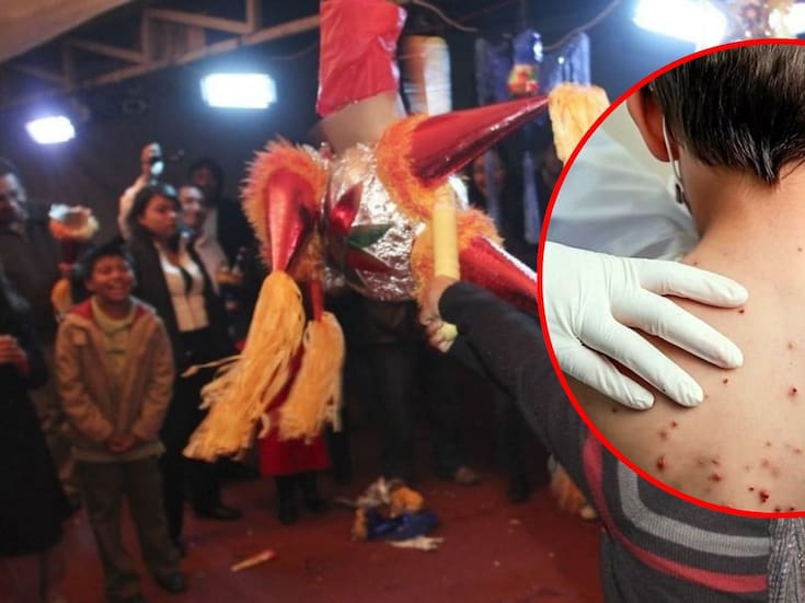 Chiapas pide cancelar eventos masivos tras detectar decenas de casos de sarampión; alerta se extendería hasta marzo de 2026