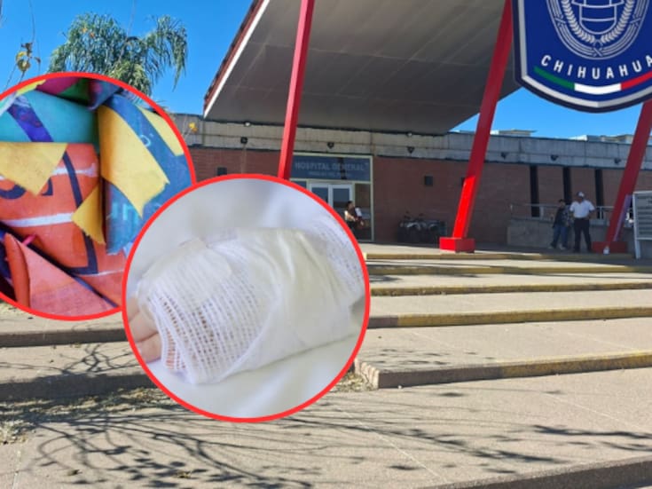 Niño de seis años pierde tres dedos de la mano por la explosión de una “palomita” en Parral, Chihuahua