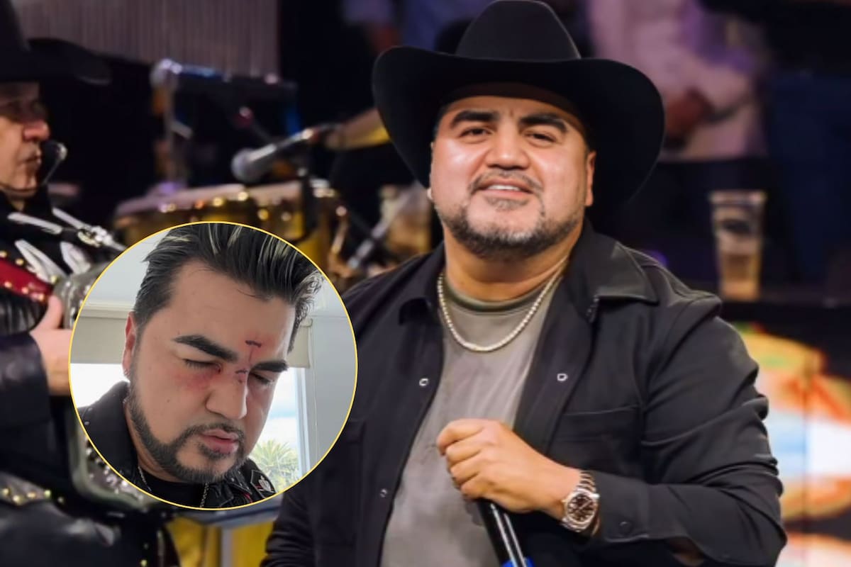 Luis Antonio “El Mimoso” preocupa a fans tras mostrarse con golpes en el rostro