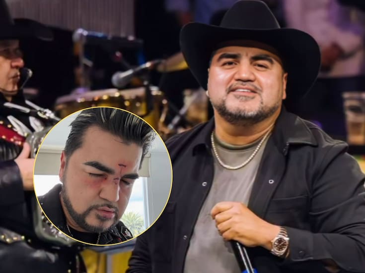 Luis Antonio “El Mimoso” preocupa a fans tras mostrarse con golpes en el rostro