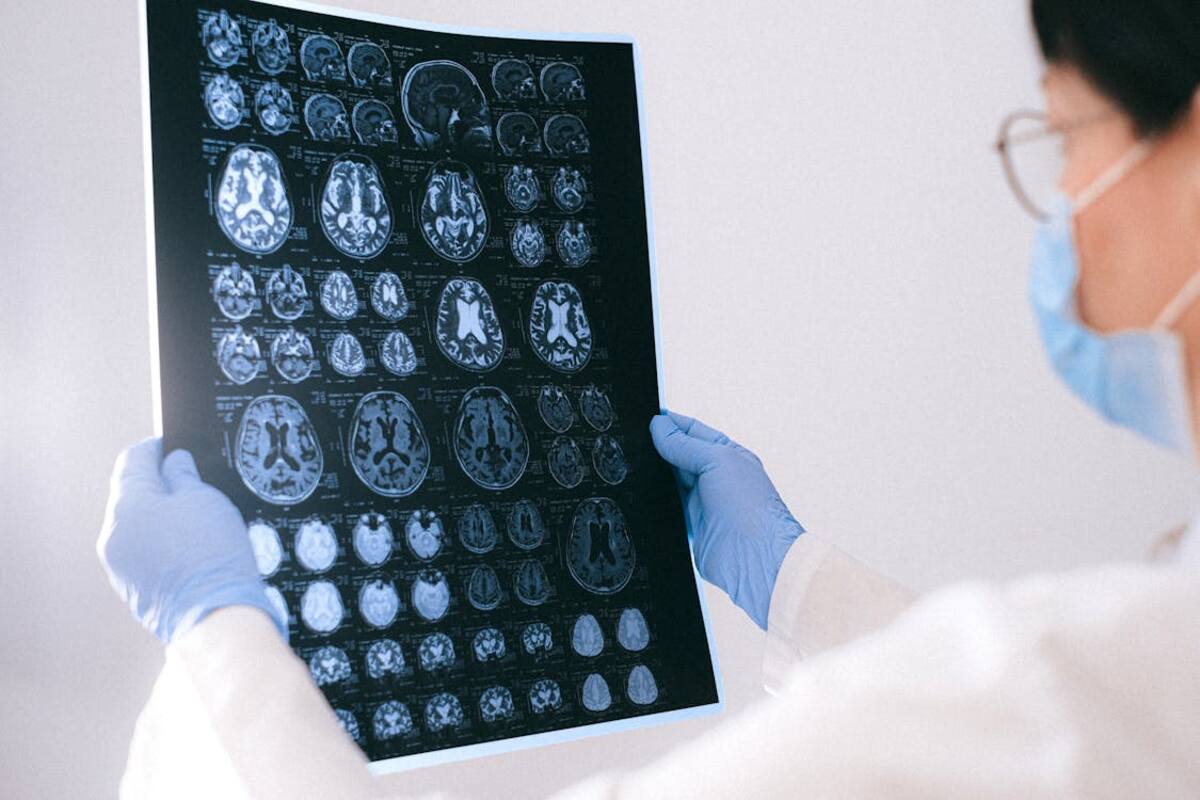 ¿Qué parte del cerebro puede ayudar a combatir el estrés?