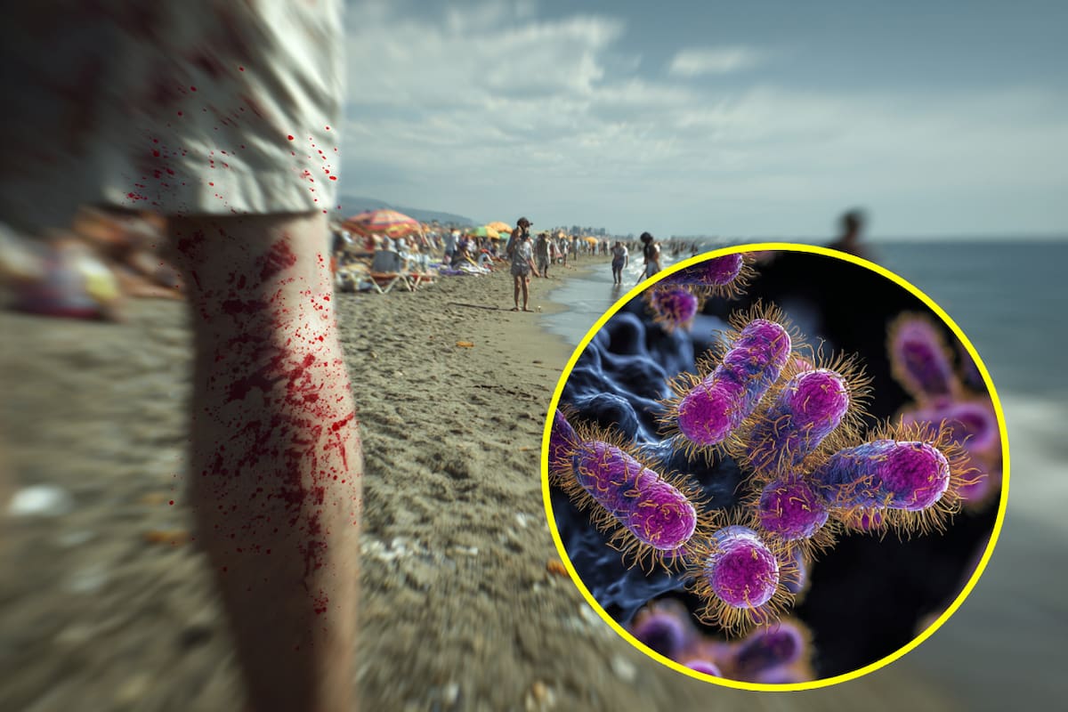Aumento de infecciones por bacteria “comecarne” en estados del Golfo de México en EEUU; van 8 muertos