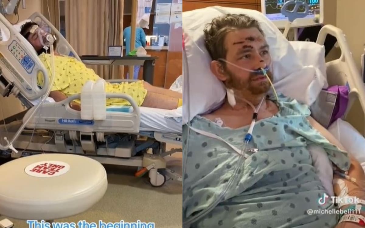 Un hombre en Texas se recuperó milagrosamente después de ser declarado con muerte cerebral y tener una tasa de supervivencia del 4% después de contraer sepsis debido a un intento de remover un pelo encarnado a finales de 2022.