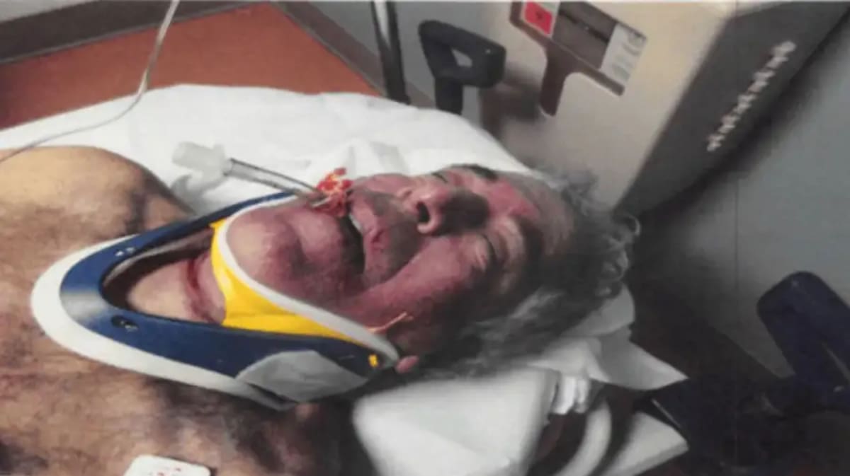 Otros archivos del Departamento de Jusitica de EEUU mostraron imágenes de lo que sería la autopsia de Jeffrey Epstein, tras morir ahorcado con sábanas en prisión. | Especial GH