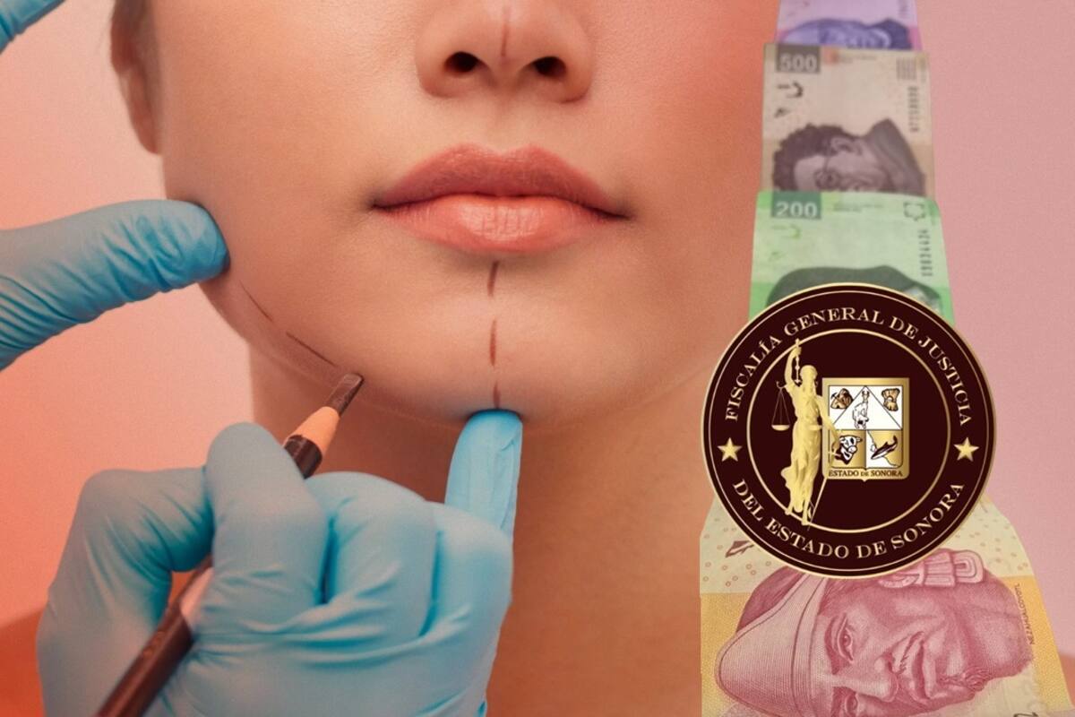 FGJE Sonora suman 50 denuncias por fraudes a empresa de cirugías por cundina