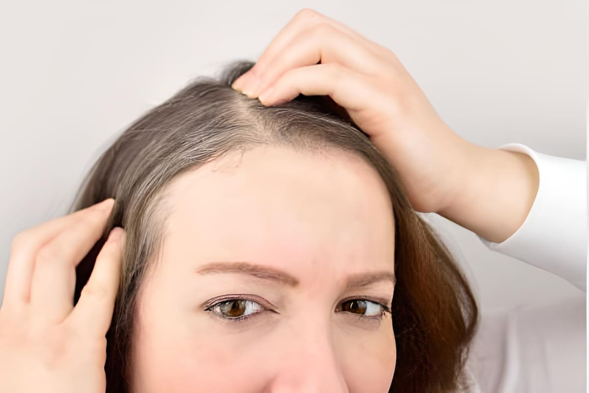 ¿Qué es más efectivo para combatir las canas: Teñir, cortar o arrancar?