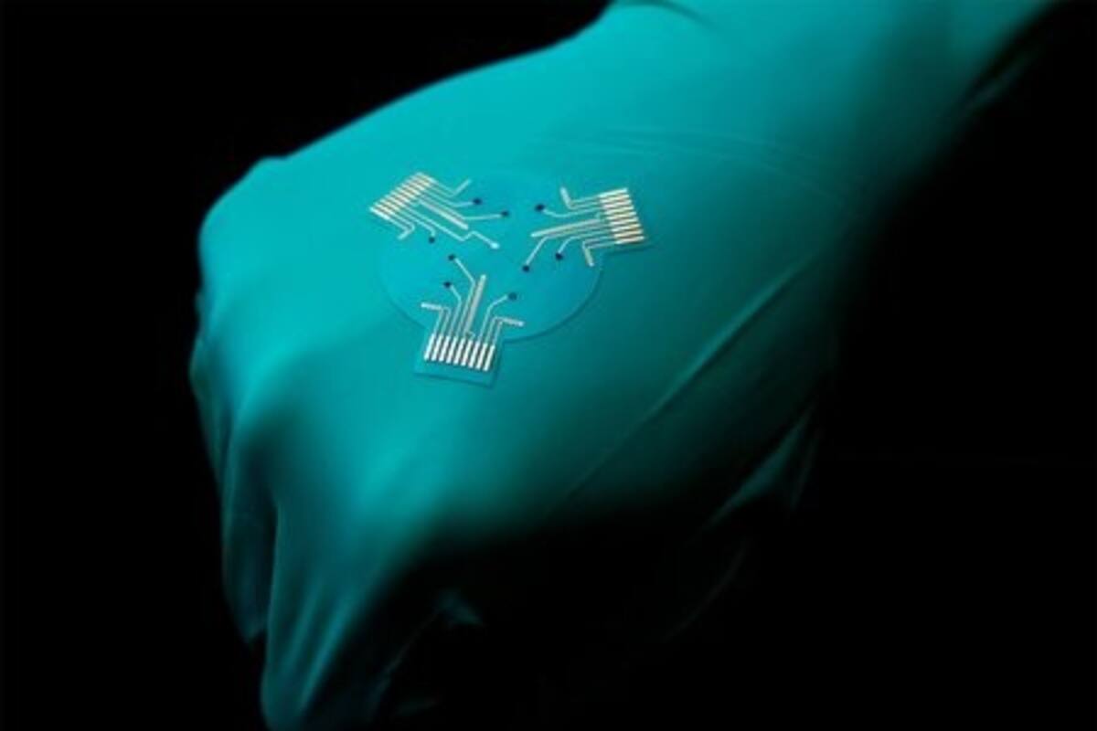 Conoce los vendajes inteligentes que podrían revolucionar el cuidado de heridas crónicas