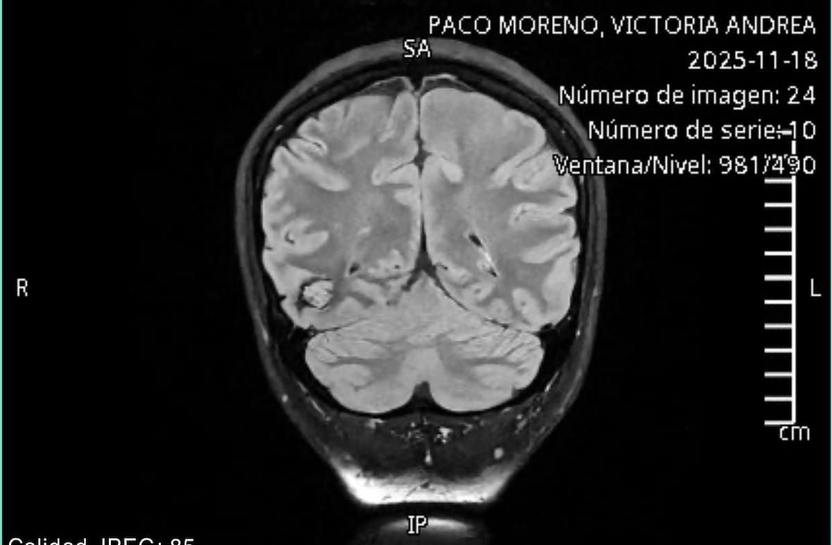 Para reducir los riesgos post operatorios es indispensable contar con instrumentos especializados que no están cubiertos por el IMSS. Foto: Cortesía