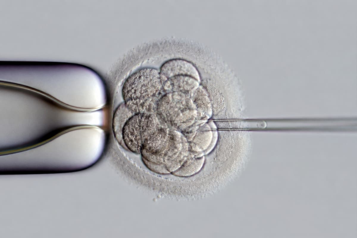 Imagen ilustrativa de un embrión humano en etapa temprana durante un procedimiento de laboratorio; científicos investigan nuevas técnicas de edición genética, aunque advierten que aún no son seguras para su uso en clínicas de fertilidad. | Imagen hecha con IA de ChatGPT