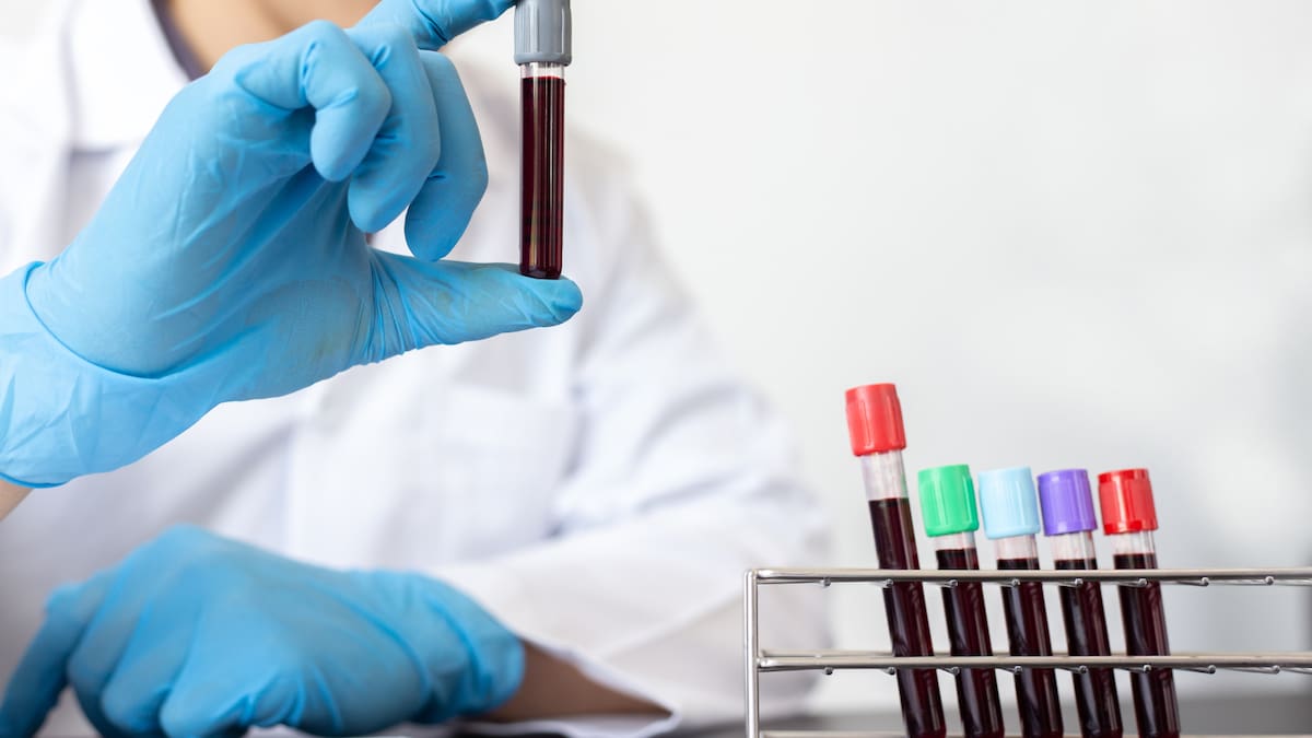 Conoce cuáles son los grupos sanguíneos más comunes y los más escasos, su importancia en la logística hospitalaria y cómo influye cada tipo en el riesgo de trombosis, compatibilidad y emergencias médicas