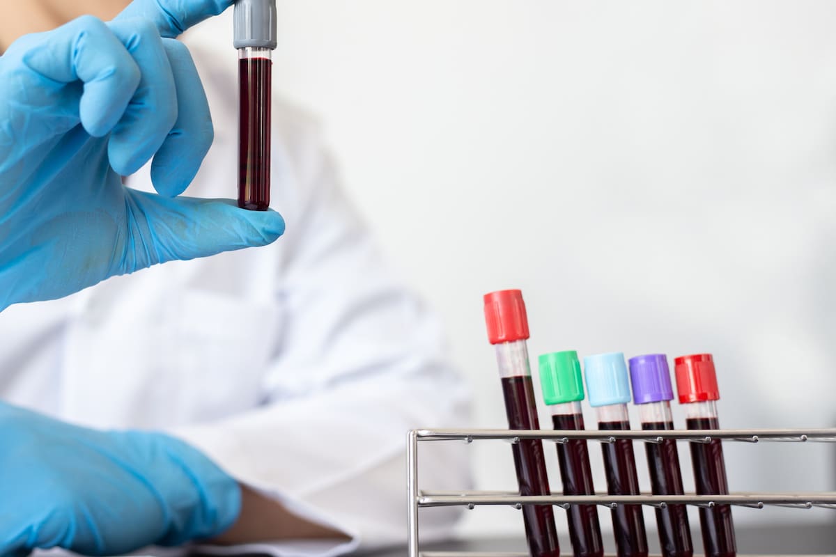 El tipo de sangre podría influir en la esperanza de vida, según estudios recientes