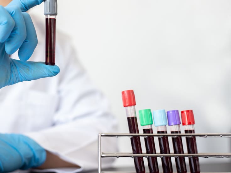 Conoce cuáles son los grupos sanguíneos más comunes y los más escasos, su importancia en la logística hospitalaria y cómo influye cada tipo en el riesgo de trombosis, compatibilidad y emergencias médicas