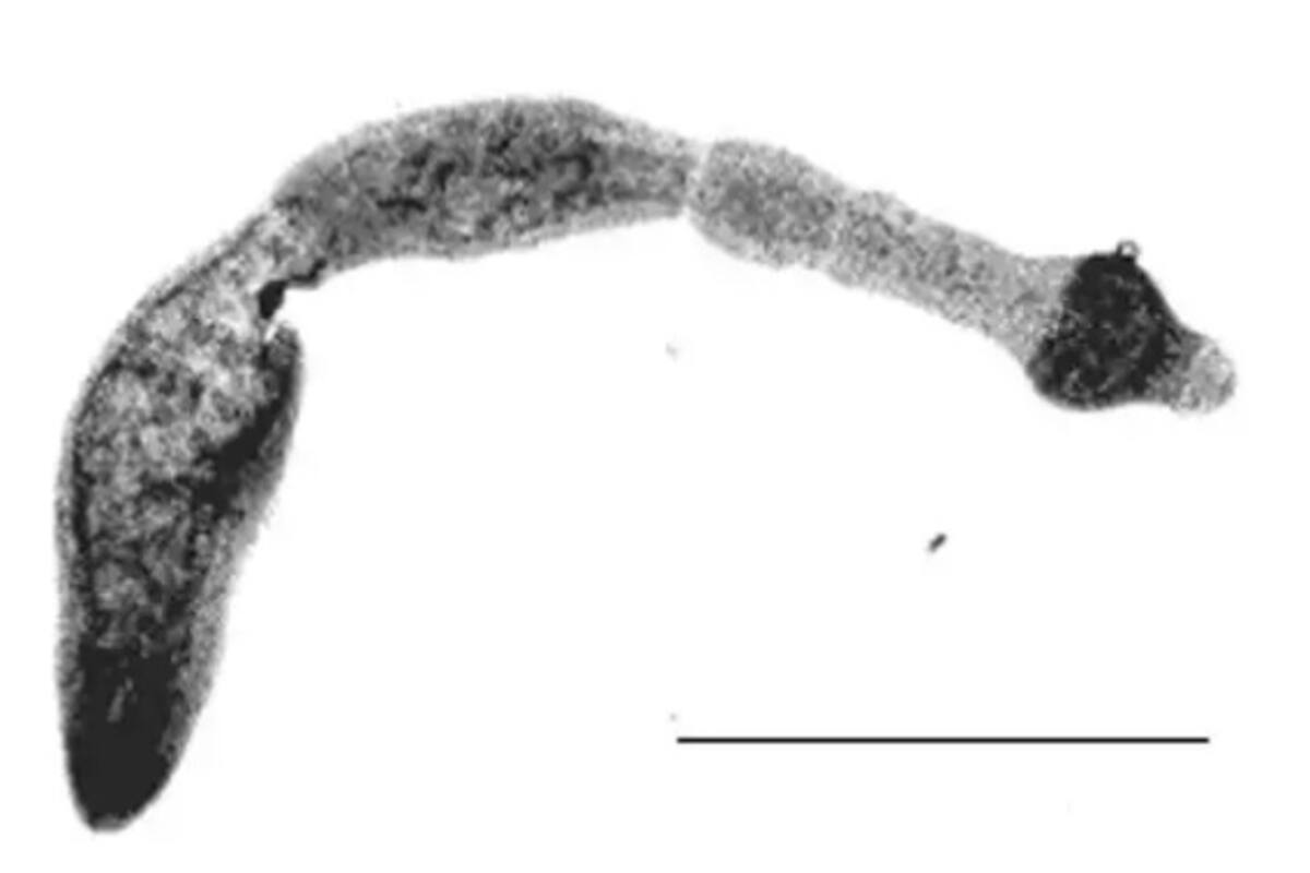 Parásito raro similar al cáncer está surgiendo en EU