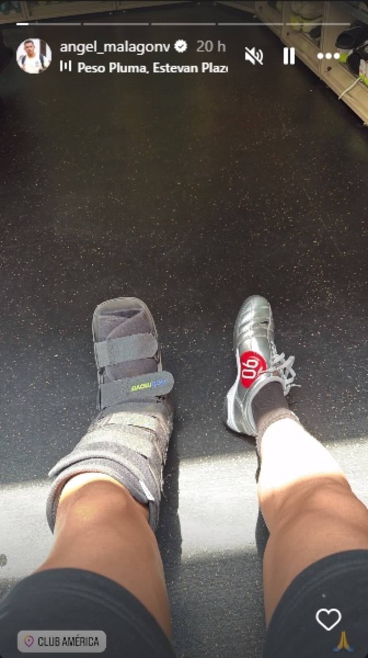 Luis Ángel Malagón publicó una historia de instagram donde se le ve utilizando una bota ortopédica. (Foto: @angel_malagonv)