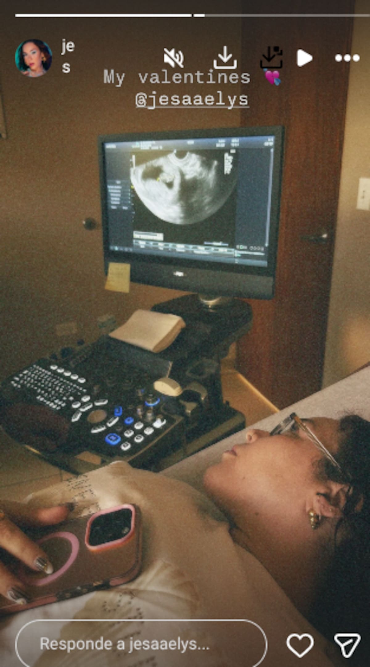 Jesaaelys Ayala confirma embarazo