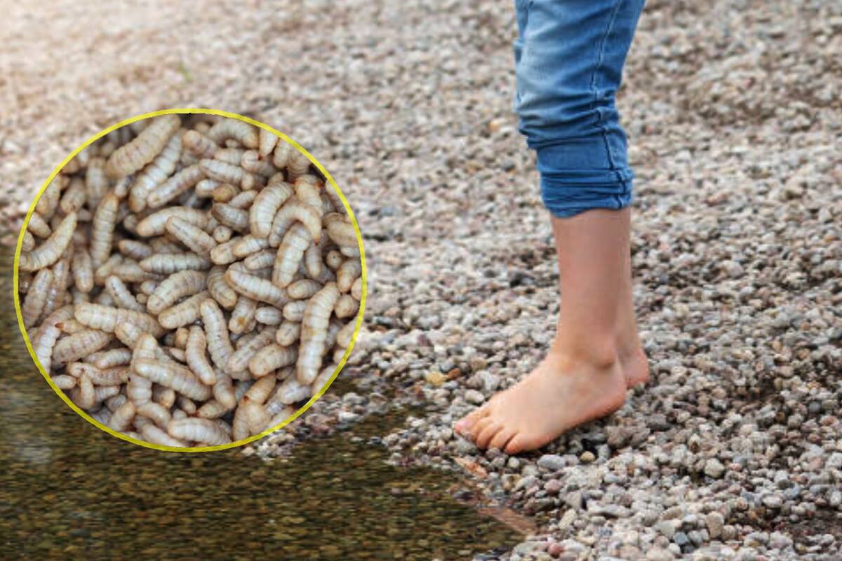 Por jugar descalzo, niño de 7 años desarrolló una infección que hace que le salgan larvas por debajo de la piel: ¿Qué es y cómo evitarla?