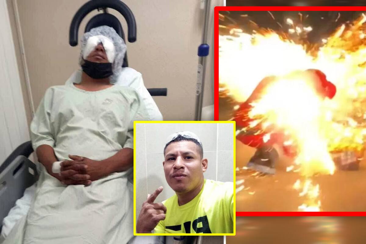 VIDEO: Cohete explota en la cara de joven vestido de Santa Claus y pierde un ojo