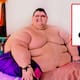 Juan Pedro Franco, el mexicano que fue hombre más obeso del mundo, murió por una infección renal con complicaciones sistémicas