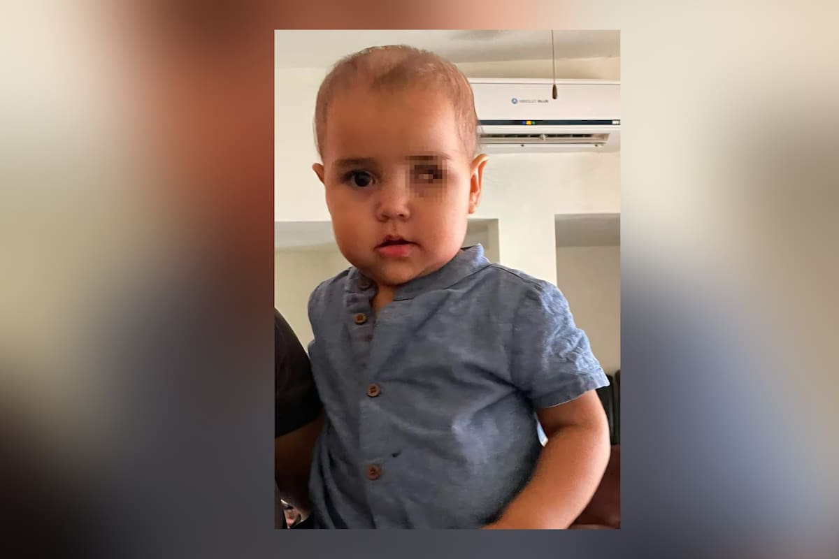 Bebé Arantza requiere apoyo con jeringas por quimioterapias oculares, así puedes ayudarle