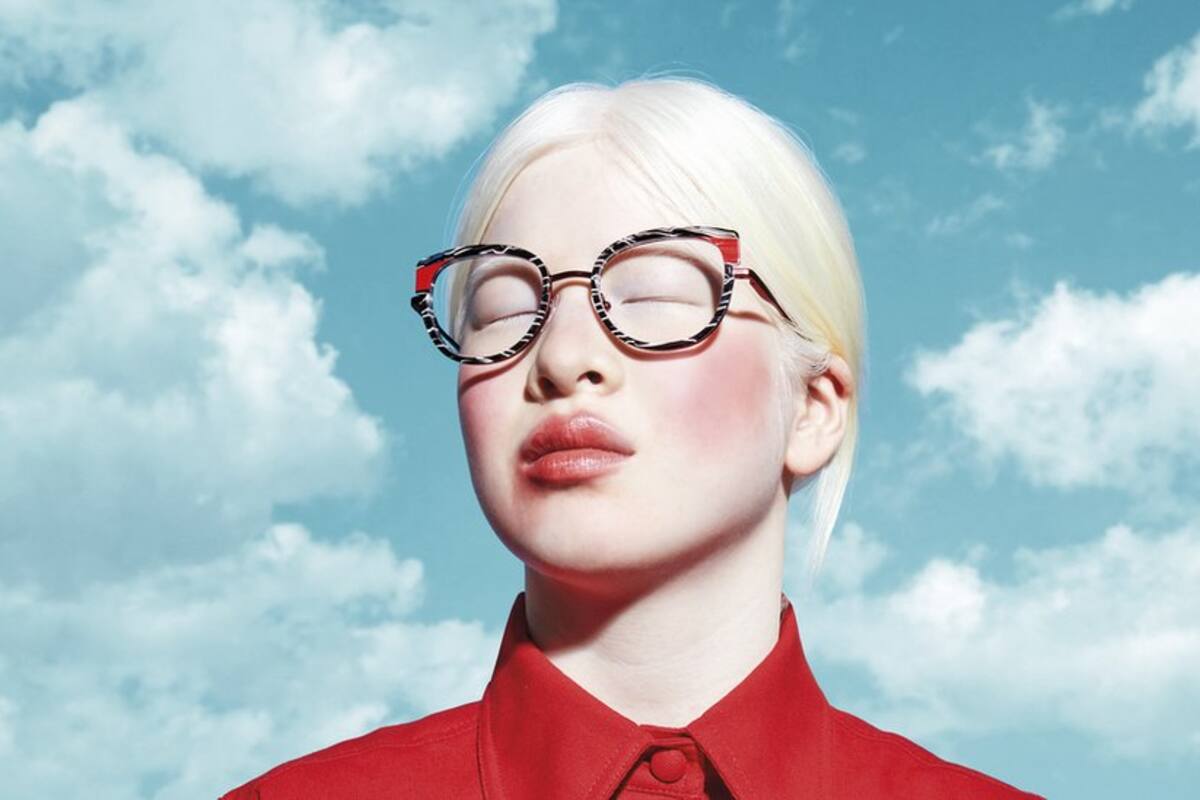 La bebé albina abandonada en China que se convirtió en modelo de Vogue