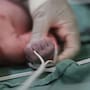 Investigan abandono y muerte de una bebé recién nacida hallada dentro de una mochila en Metepec y que aún conservaba el cordón umbilical