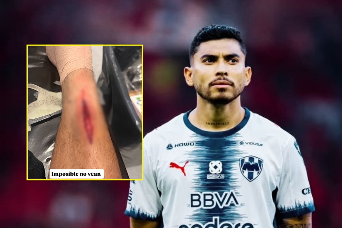 ¡Impresionante! Así quedó la pierna de Orbelín Pineda tras la fuerte entrada en el Atlas vs Rayados