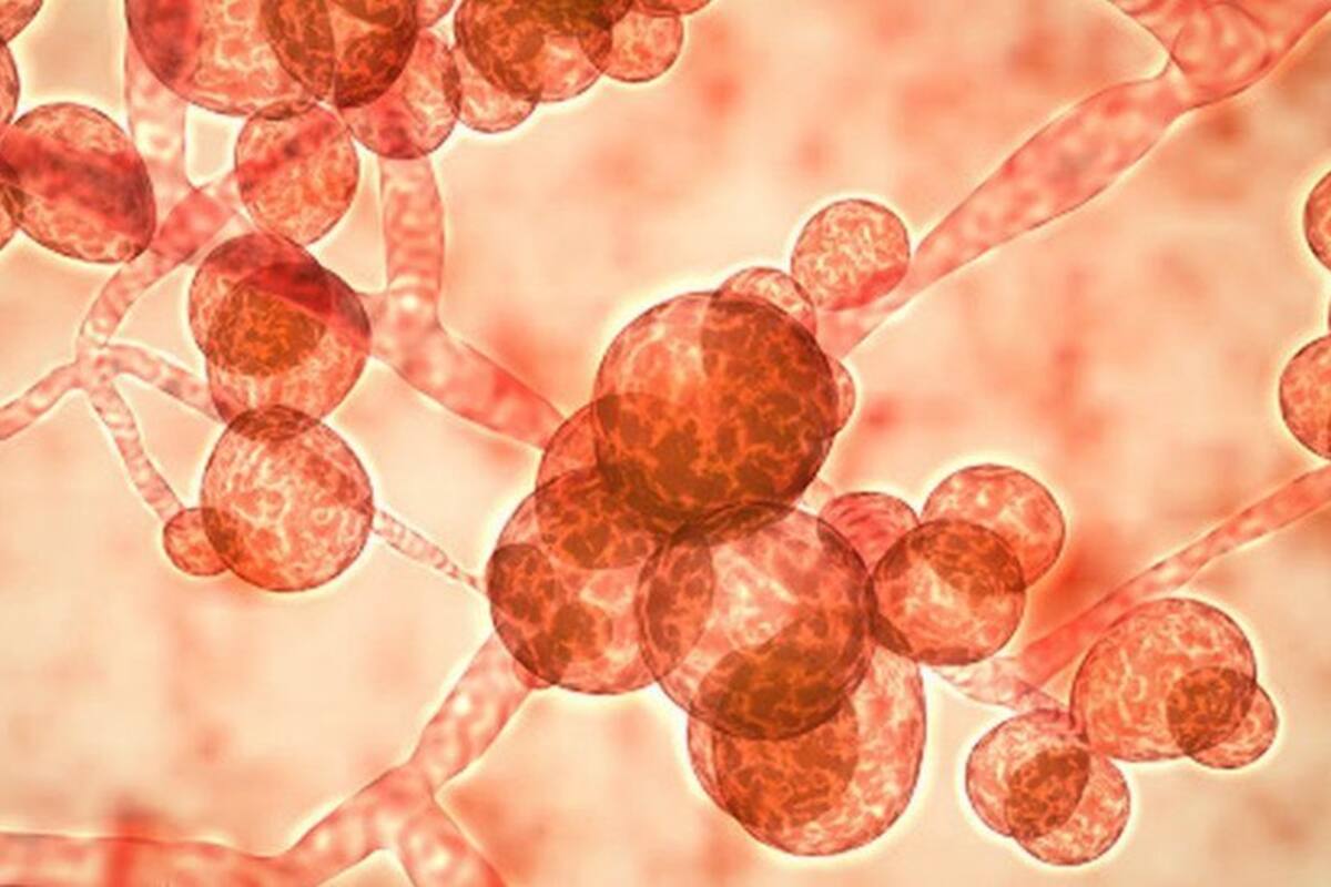 Coronoavirus: Candida auris, el otro hongo resistente a los antibióticos que amenaza la recuperación de los pacientes con covid-19 en India