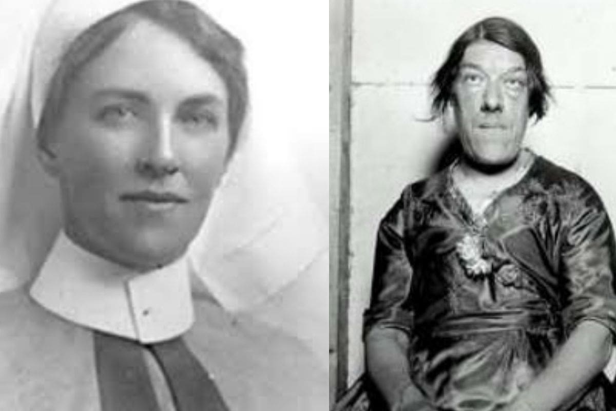 De una hermosa enfermera a la “mujer más fea del mundo”; la desgarradora historia de Mary Ann Webster