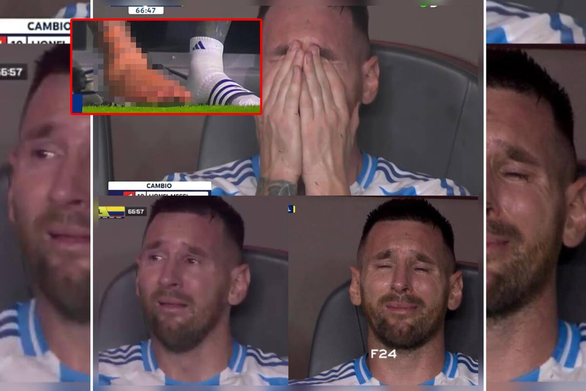 Así quedó el pie de Messi tras salir llorando de la final de la Copa América