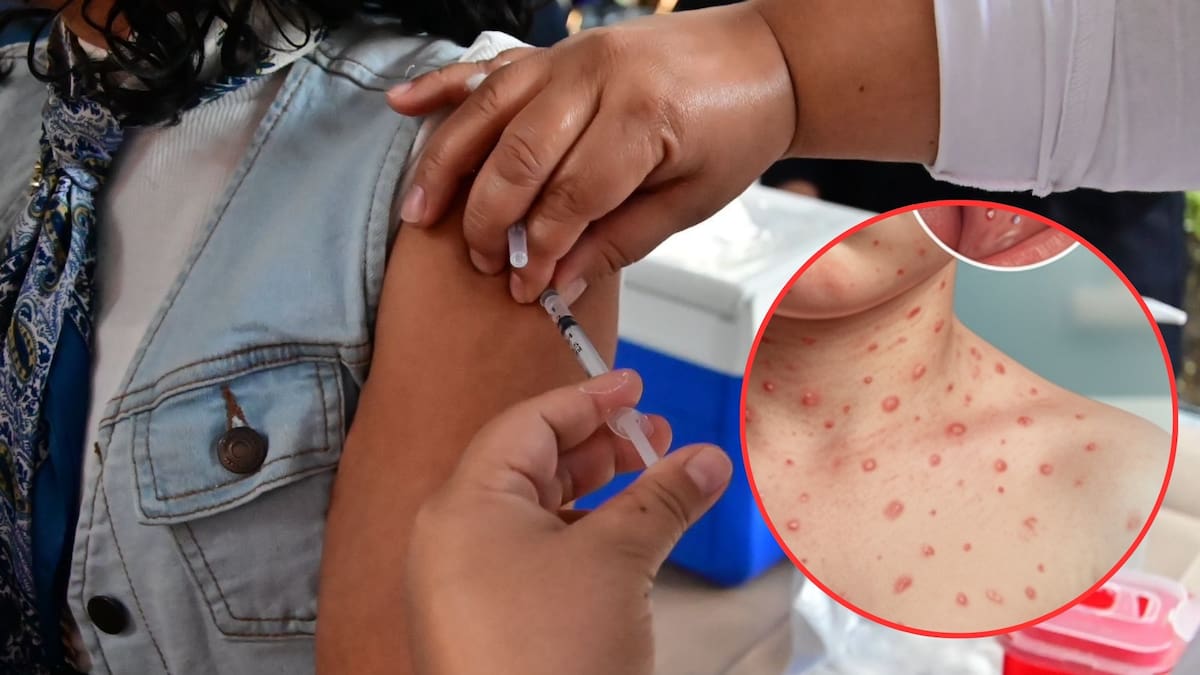 Secretaría de Salud llama a población de 6 meses a 49 años a vacunarse contra sarampión tras aplicar 17.2 millones de dosis y mantener meta de 25 millones en 10 semanas