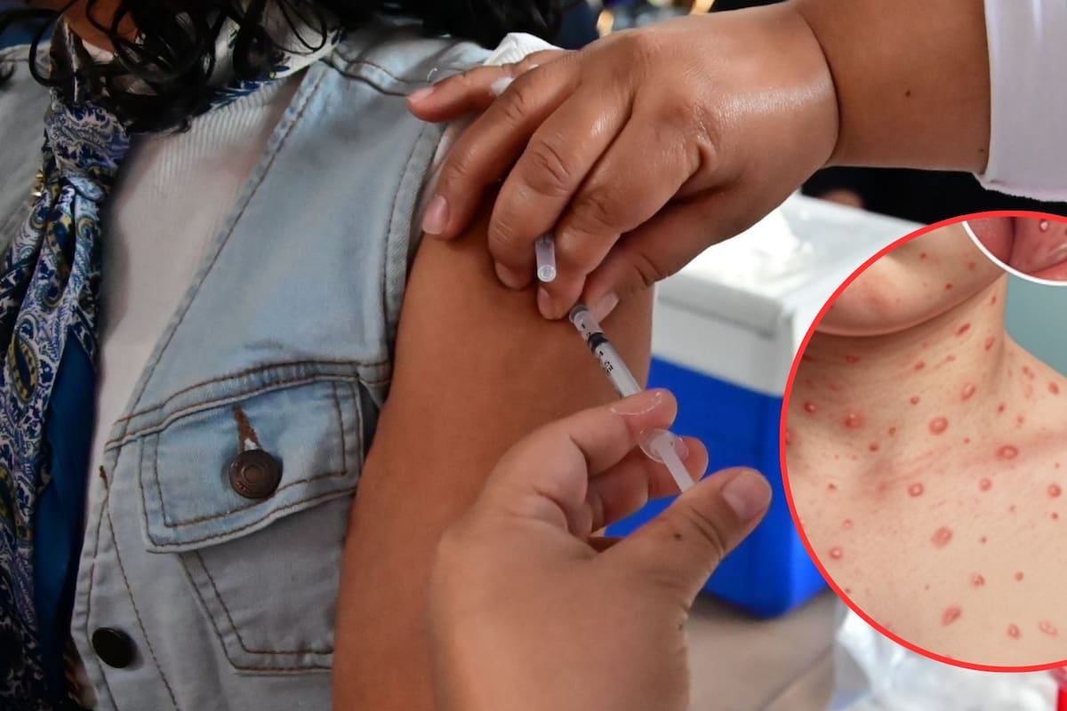 Secretaría de Salud llama a población de 6 meses a 49 años a vacunarse contra sarampión tras aplicar 17.2 millones de dosis y mantener meta de 25 millones en 10 semanas