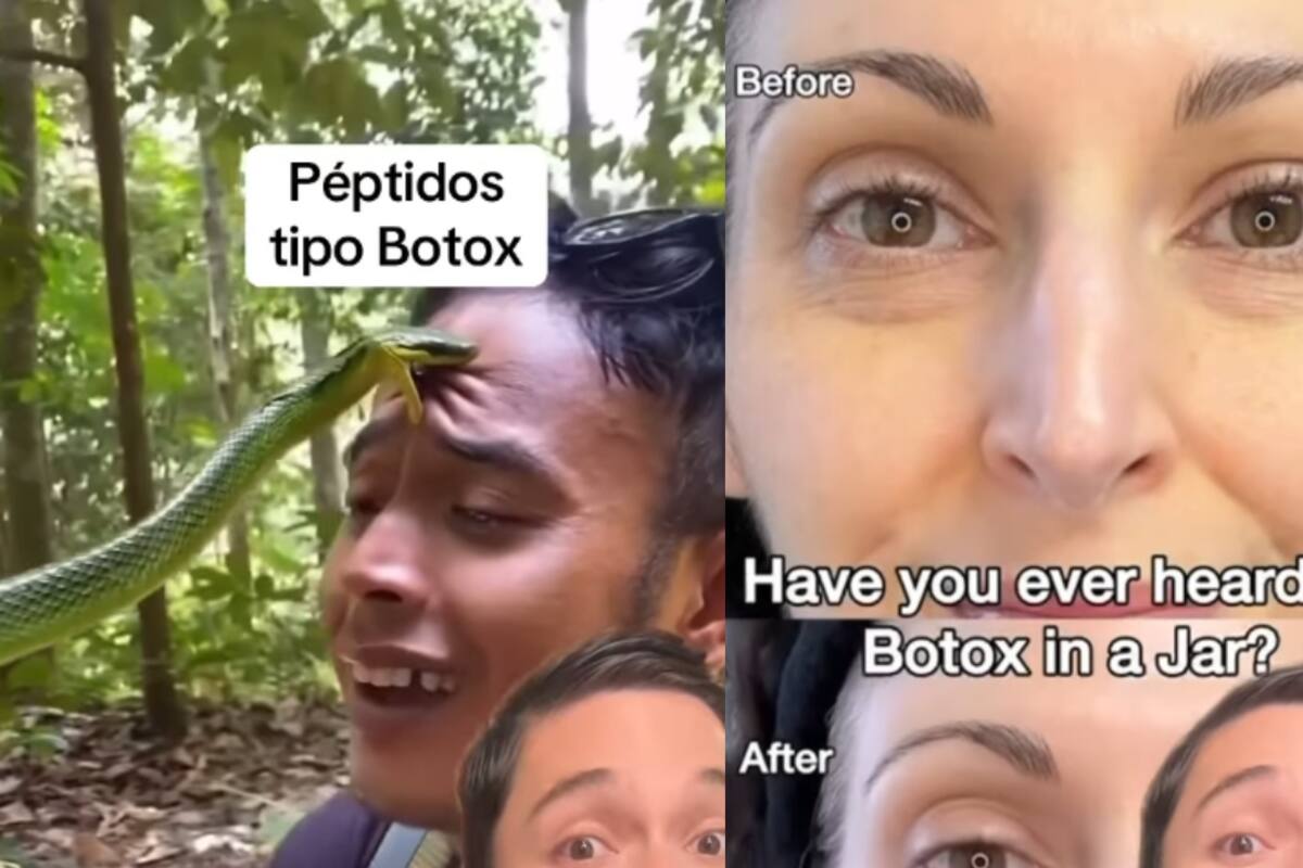 IMPRESIONANTE: Así usan el veneno de serpiente como botox para eliminar arrugas