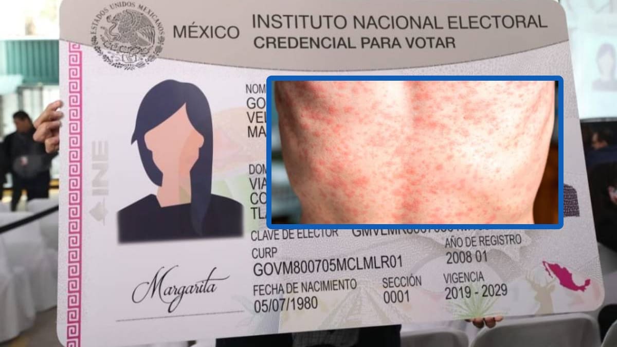 INE reveló las mismas tres medidas claves que se aplicaron en durante la pandemia del Covid, pero esta vez para prevenir el incremento de brotes de sarampión, luego que tras detectara un caso en sus instalaciones