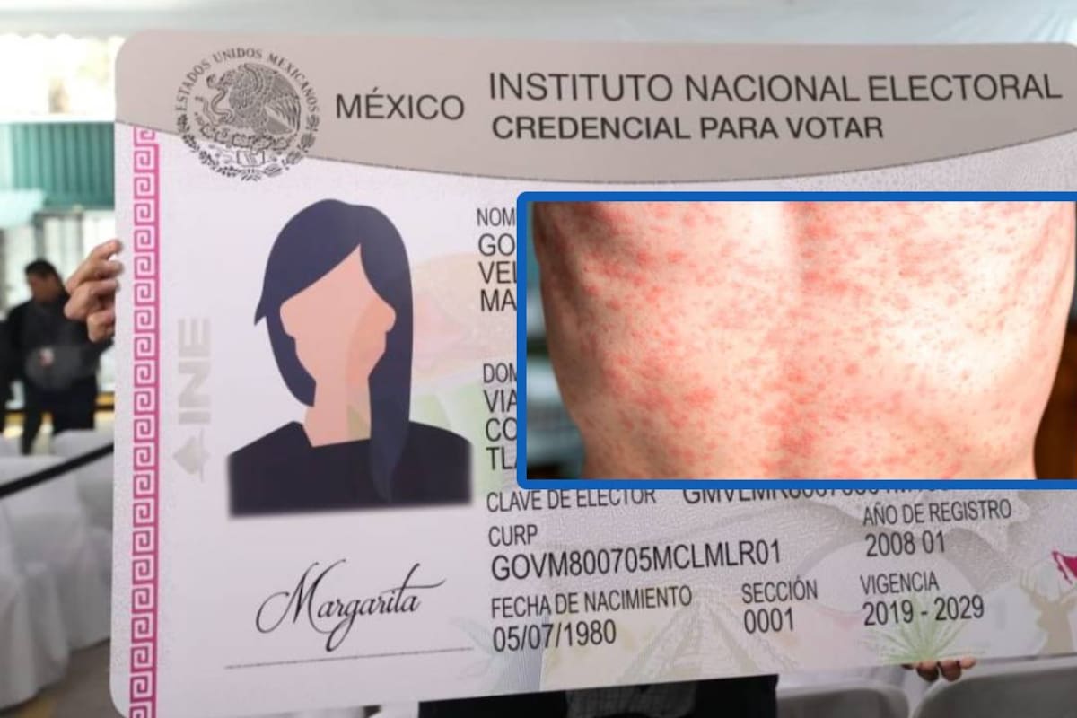 INE reveló las mismas tres medidas claves que se aplicaron en durante la pandemia del Covid, pero esta vez para prevenir el incremento de brotes de sarampión, luego que tras detectara un caso en sus instalaciones