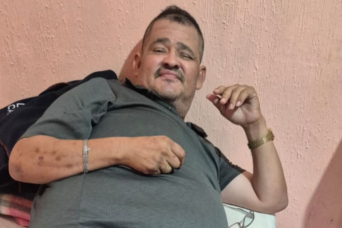 José Manuel, víctima de araña violinista, busca ayuda para costear tratamientos médicos urgentes