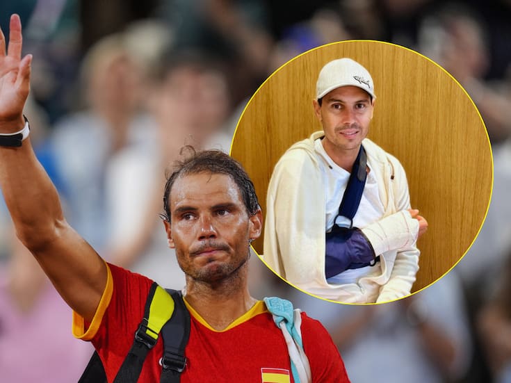 ¿Por qué operaron de la mano a Rafael Nadal?