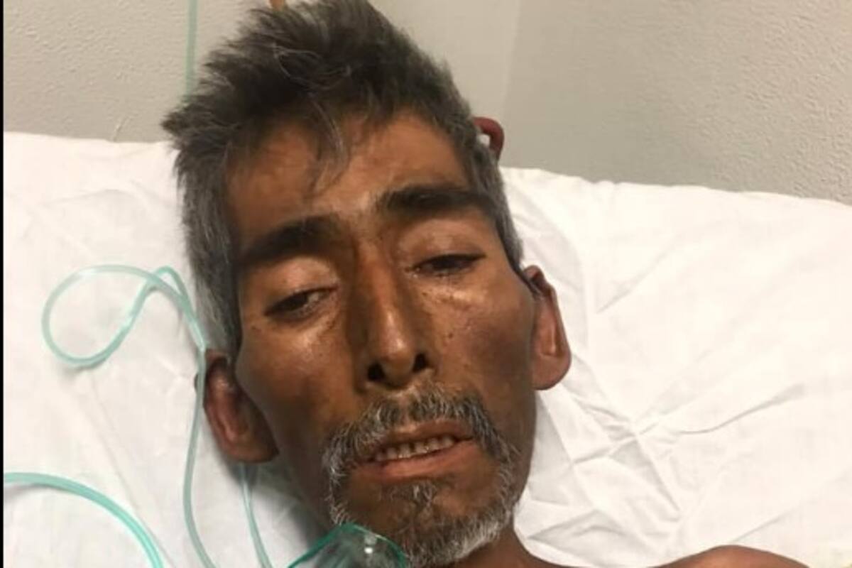 Buscan a la familia de Alberto; él está en el hospital de SLRC