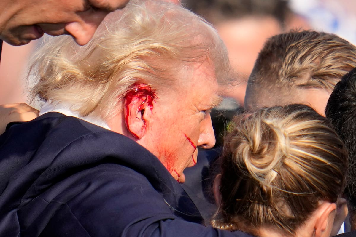 “Estoy vivo de milagro” Primeras declaraciones de Trump tras atentado