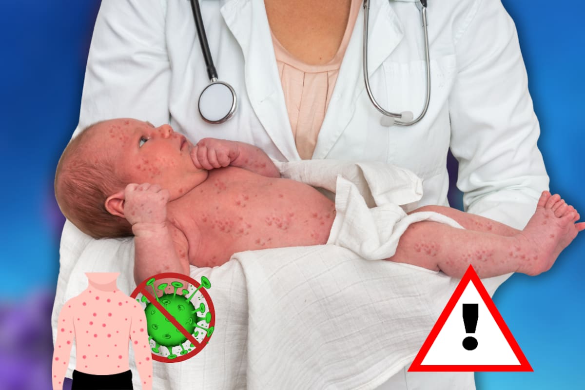 Este es el error que se comete en casa y dispara el contagio de sarampión, alertan expertos
