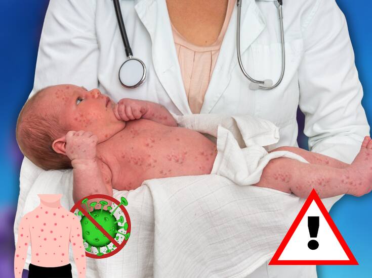 Este es el error que se comete en casa y dispara el contagio de sarampión, alertan expertos