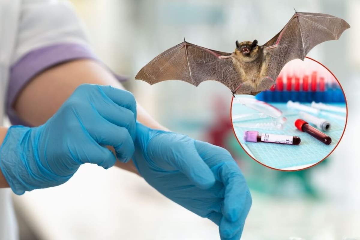 ¿Qué es el virus Nipah, cuáles son sus síntomas y cómo se transmite esta enfermedad que genera alerta sanitaria desde la India?