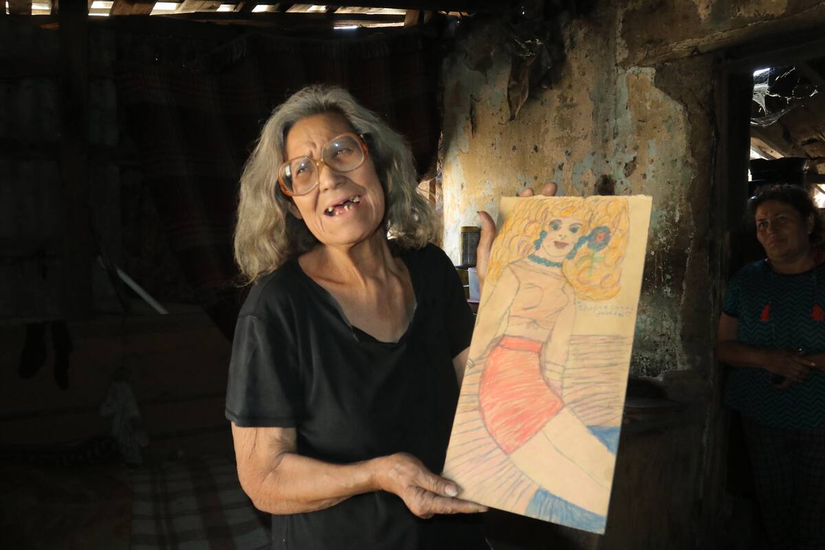 María del Carmen necesita apoyo para comer