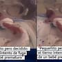 “Siento que nació prematuro porque no podía estarse quieto”: Bebé prematuro enternece a las redes al intentar salir de su incubadora