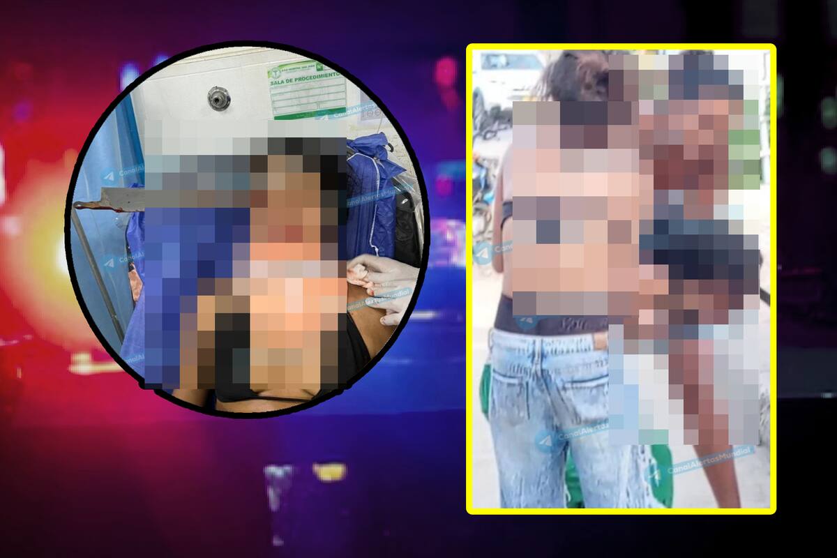 VIDEO: Vecinas se pelean en plena calle y una acaba con machete encajado en la cabeza (Imágenes fuertes)